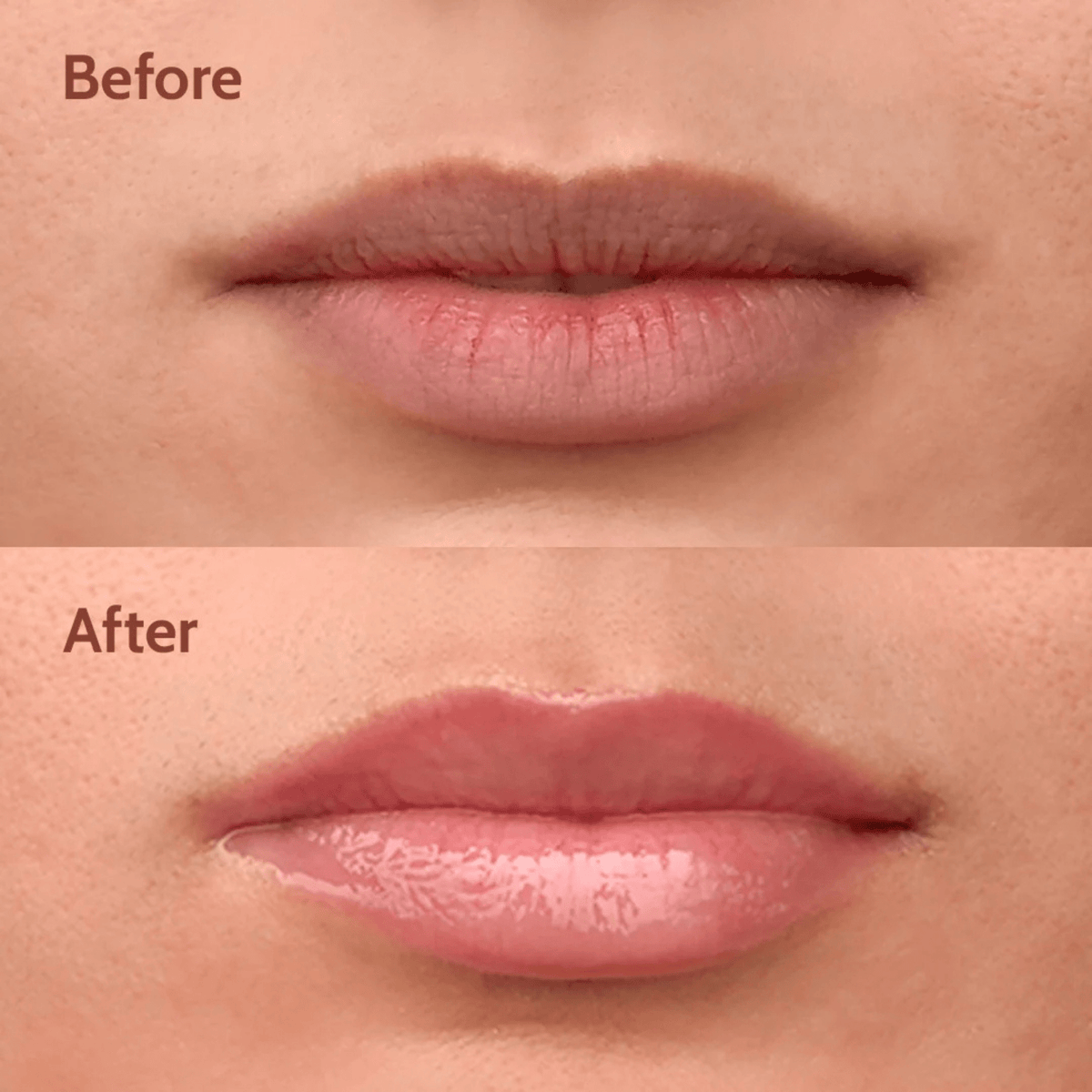The Viral Lip Balm Everyone with Dark, Dry Lips is Talking About - LazyLizard-skincare