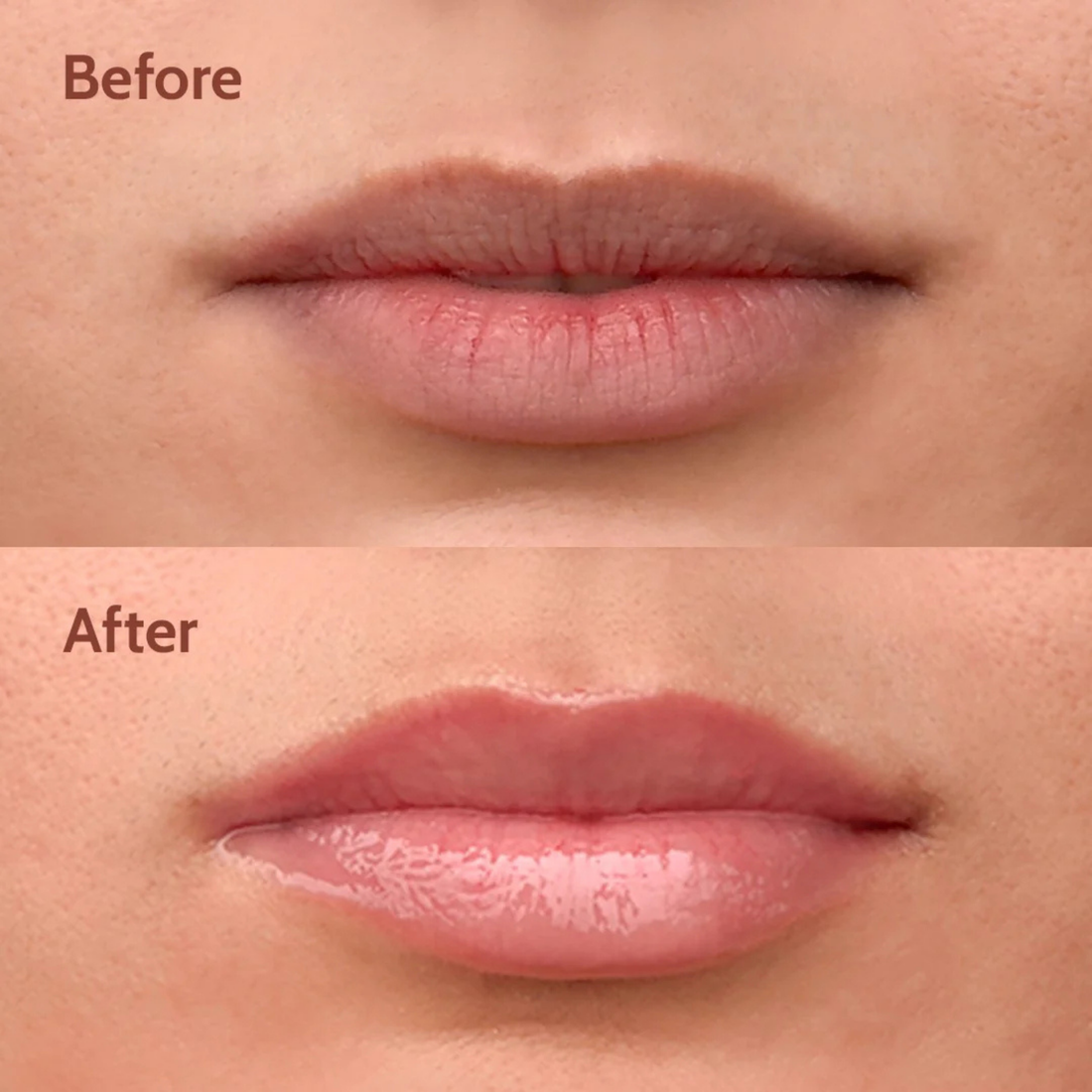 The Viral Lip Balm Everyone with Dark, Dry Lips is Talking About