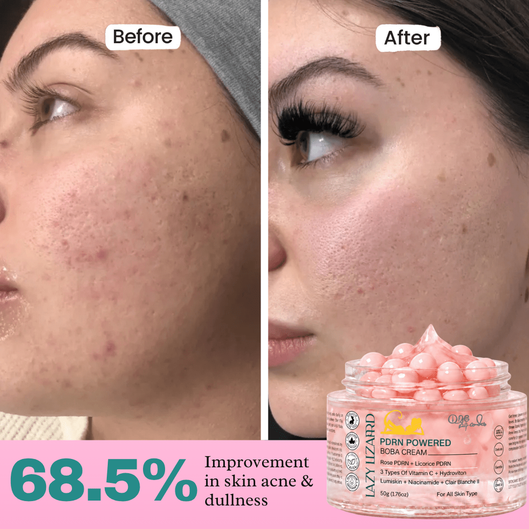 PDRN Boba Cream for Glass Glow & Deep Hydration – 55g - LazyLizard-skincare