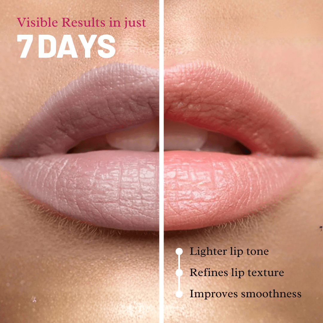 Lazy Lizard Brightening Lip Balm SPF 30 – Treats Pigmentation, UV Damage & Smoker's Lips - LazyLizard-skincare