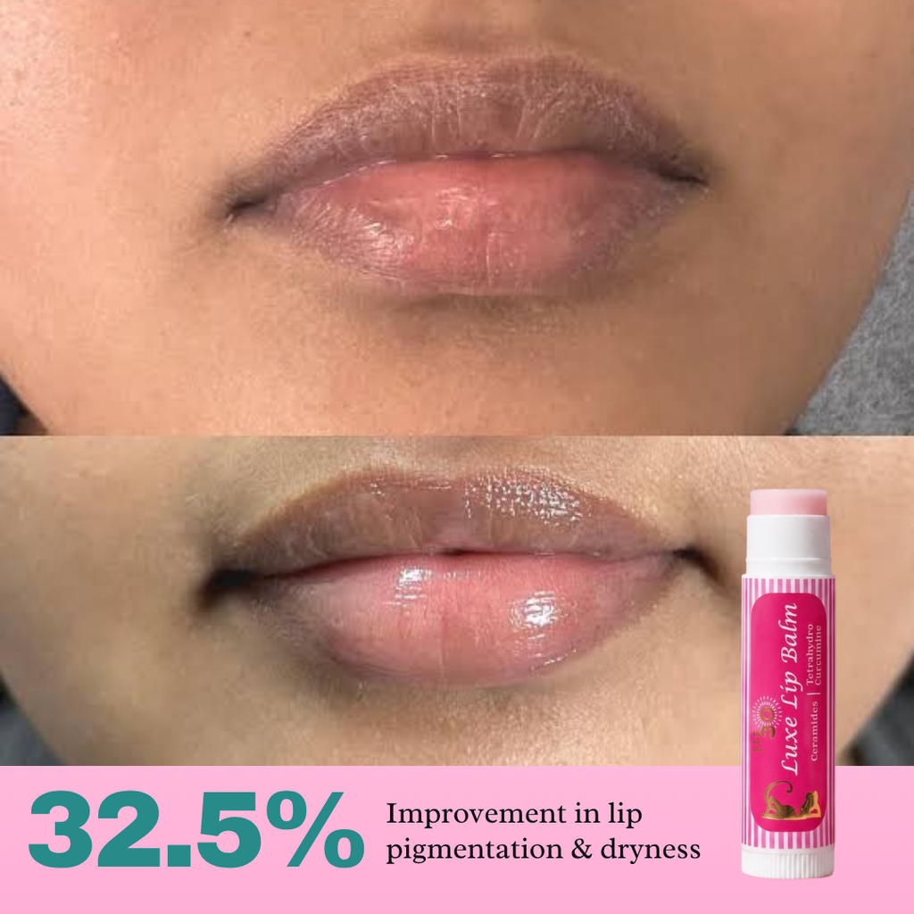 Lazy Lizard Brightening Lip Balm SPF 30 – Treats Pigmentation, UV Damage & Smoker's Lips