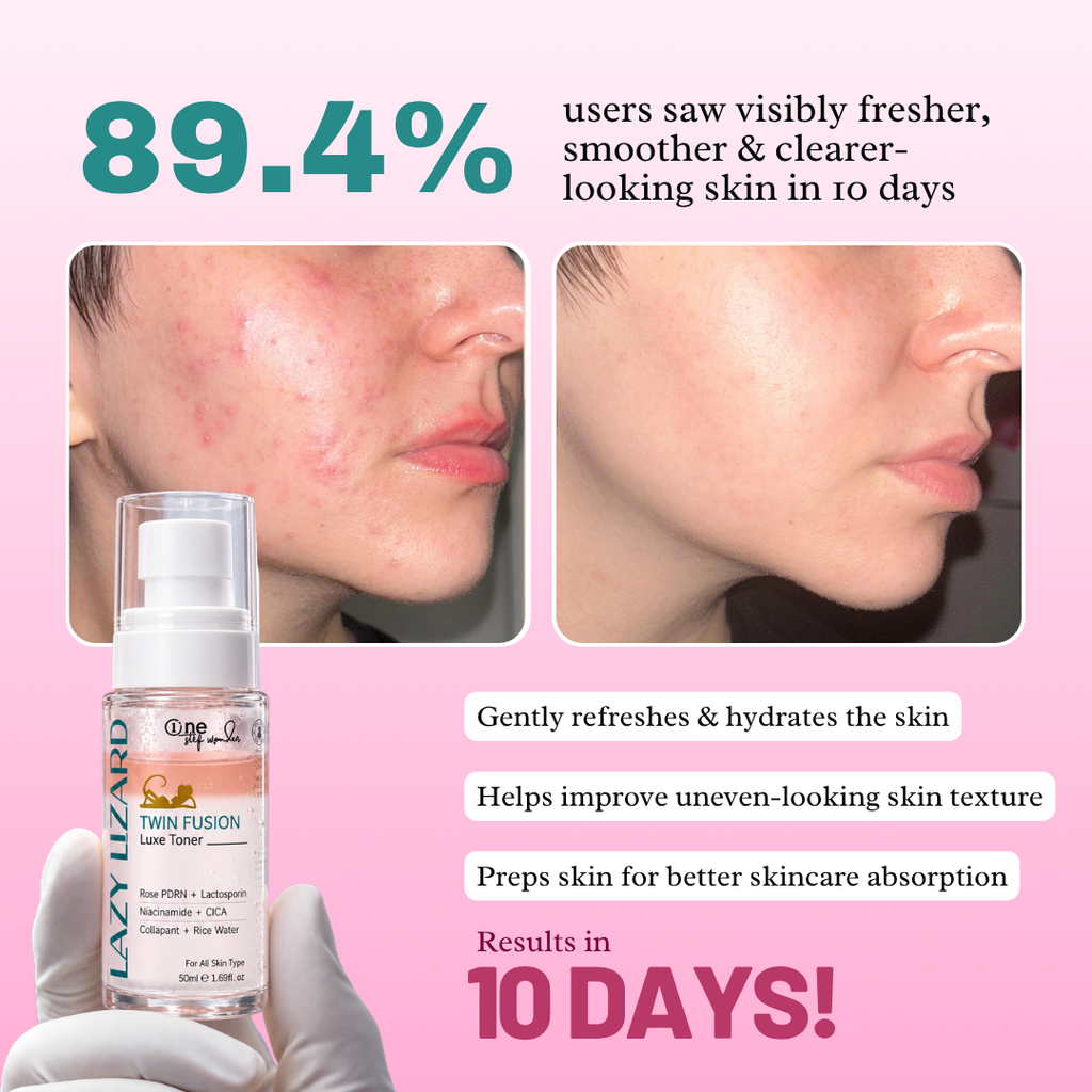 Lazy Lizard Twin Fusion Hydrating Face Toner