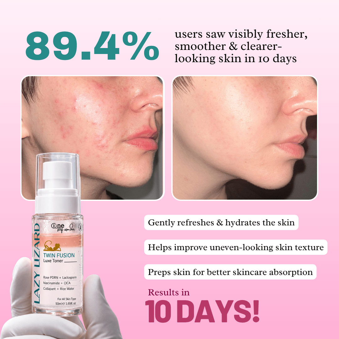 Lazy Lizard Twin Fusion Hydrating Face Toner - LazyLizard-skincare